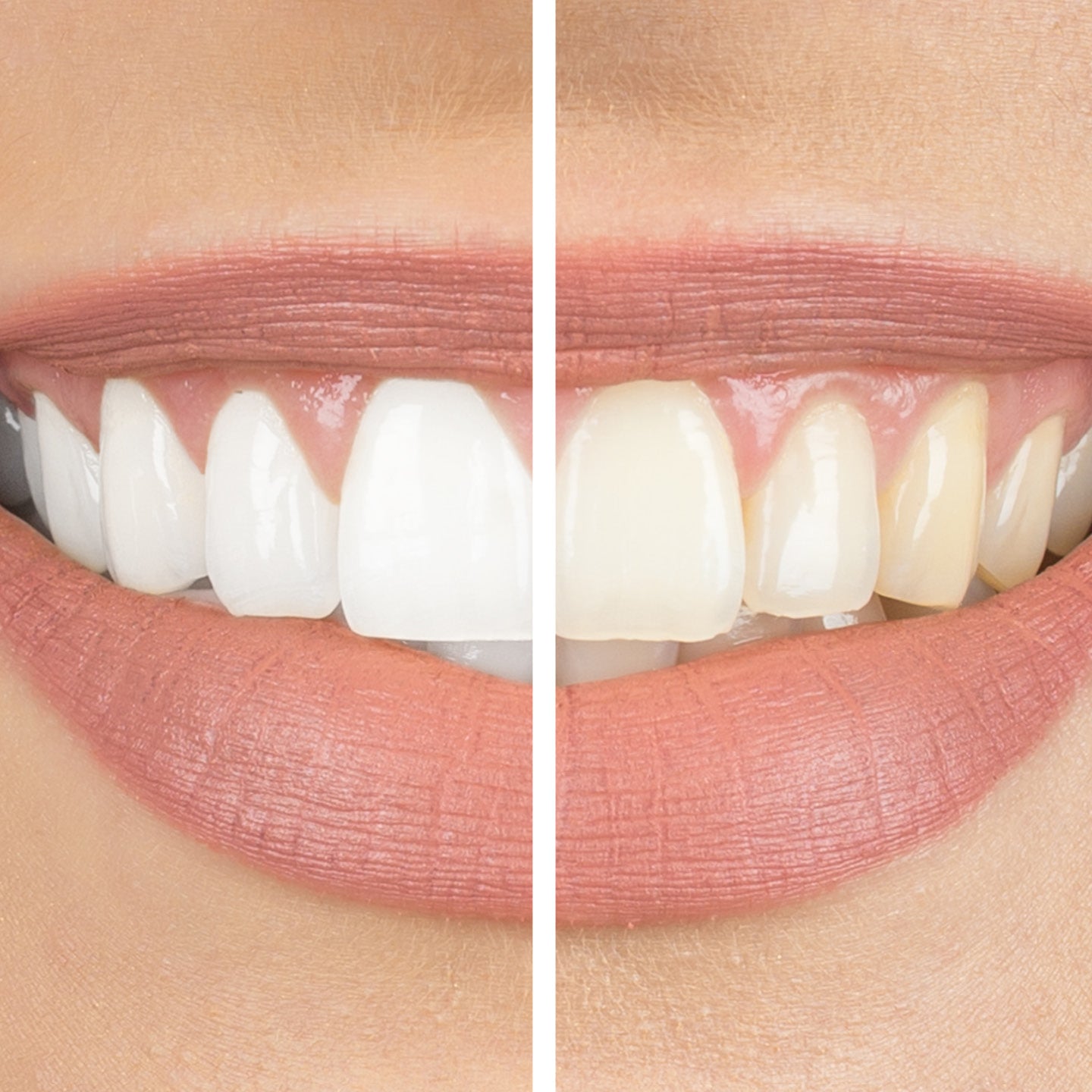 Origin - Non Peroxide PAP