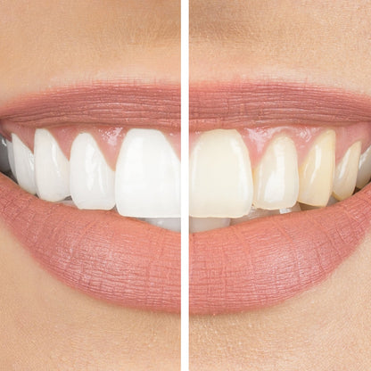 Origin instants PAP: 5 pack bundle